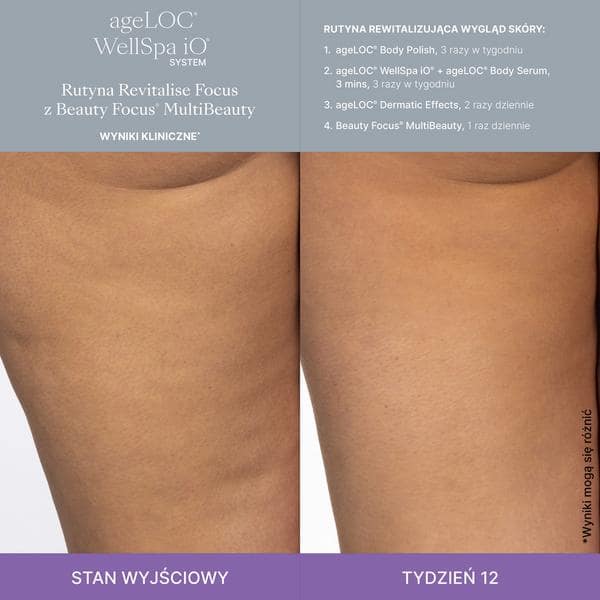 WellSpa-iO-MultiBeauty-Before-After-Images-1200-1200-pixels-PL2_1-min