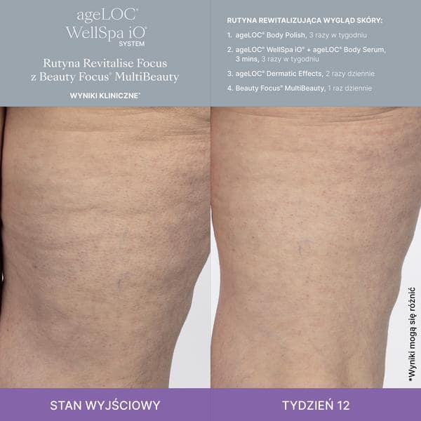 WellSpa-iO-MultiBeauty-Before-After-Images-1200-1200-pixels-PL3_1-min