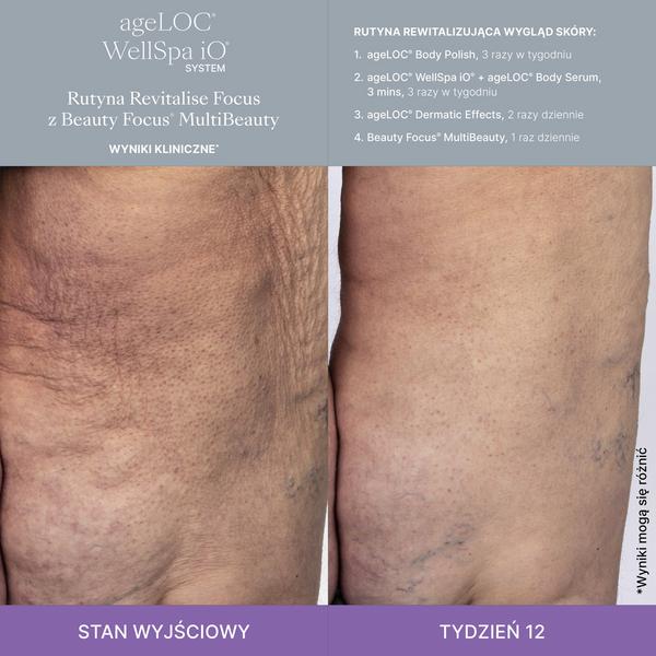 WellSpa-iO-MultiBeauty-Before-After-Images-1200-1200-pixels-PL_1-min