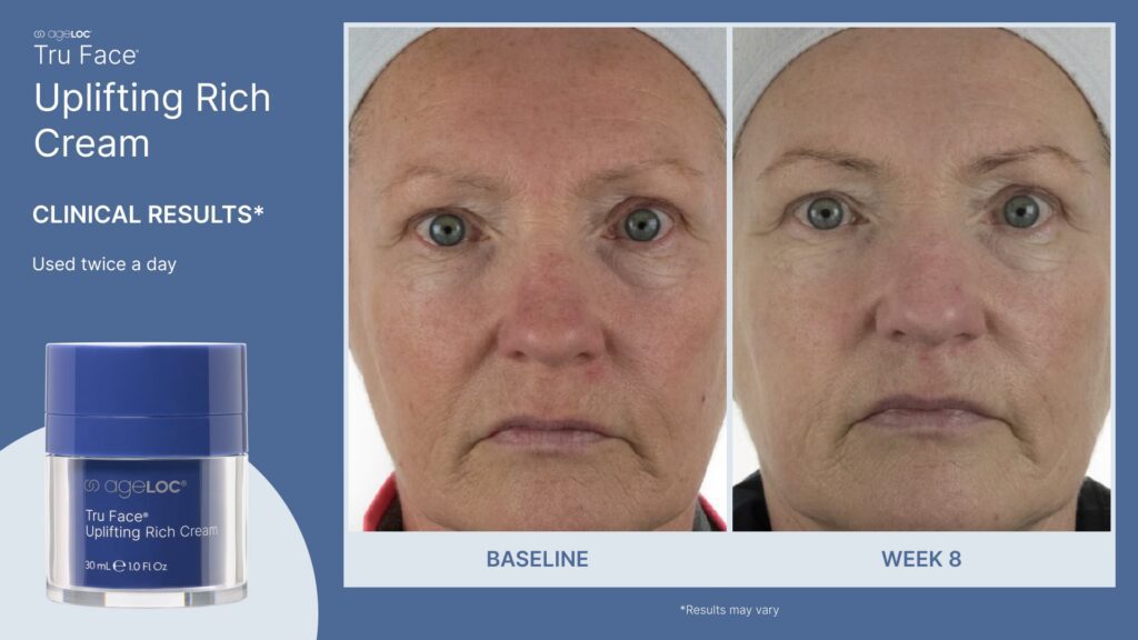 ageLOC Tru Face Uplifting Rich Cream Clinical Results Post 1-min