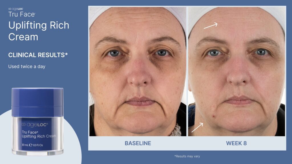 ageLOC Tru Face Uplifting Rich Cream Clinical Results Post 2 (1)-min