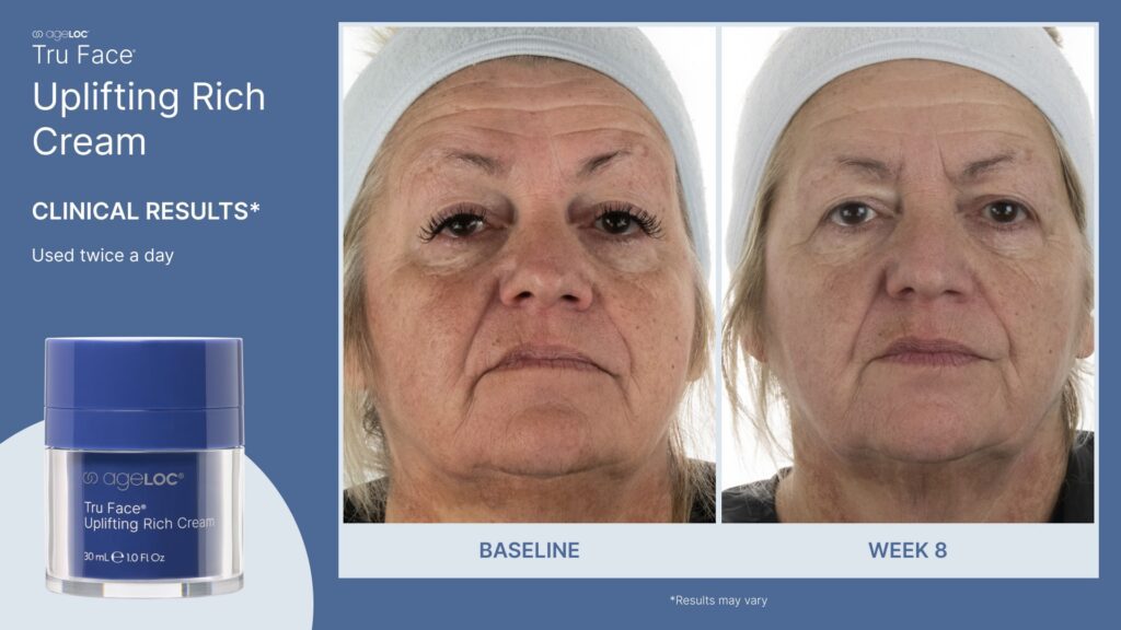 ageLOC Tru Face Uplifting Rich Cream Clinical Results Post 3-min