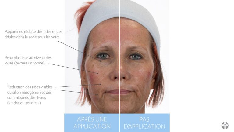 ageloc-facial-gels-before-after-fr_page4-min