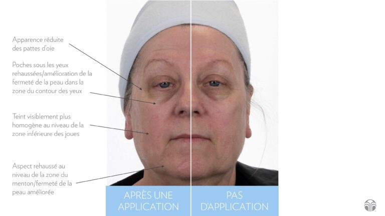 ageloc-facial-gels-before-after-fr_page5-min