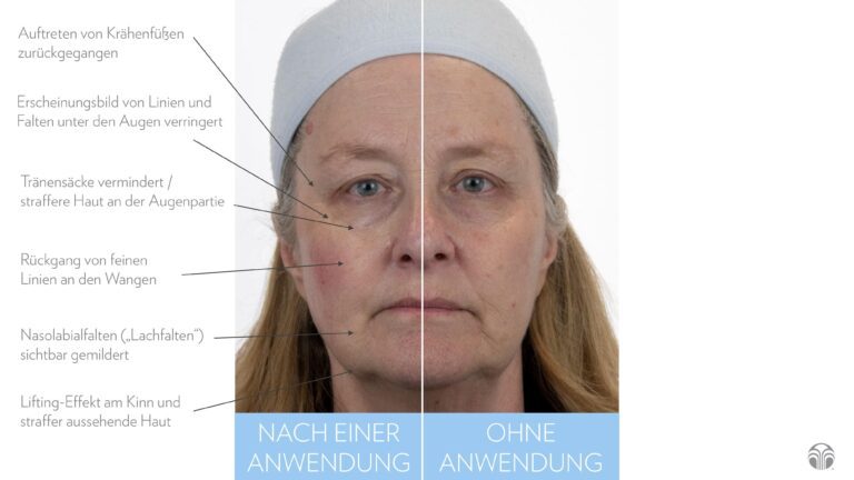 ageloc_facial_gels_DE_page_3-min