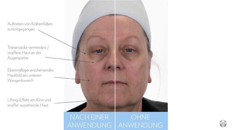 ageloc_facial_gels_DE_page_5-min